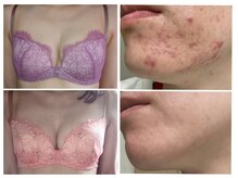 レヴェイユ(Reveil)