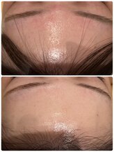 エイシスグロウ(asis glow.)/ララピール×水玉リフティング