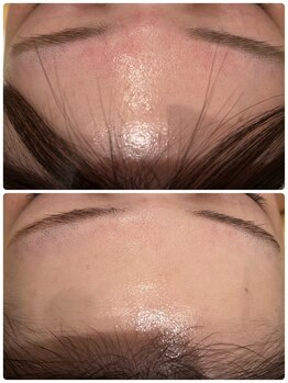 エイシスグロウ(asis glow.)/ララピール×水玉リフティング