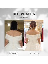 ティースタイル(T-Style)/ブライダル before/after