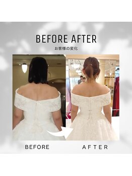 ティースタイル(T-Style)/ブライダル before/after