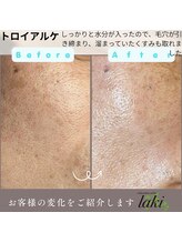 リラクゼーションサロン ラキ(laki)/トロイアルケ、施術後