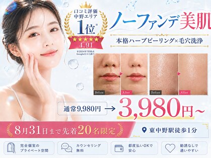 メルヴェイユの写真