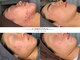 サロン キュー(Salon Cue)の写真