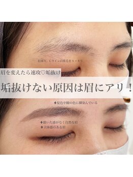 ホワイトアイ 谷町四丁目(WHITE EYE)/