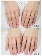 ネイル キャンバス シルヴァ(Nail Canvas Silva.)/赤のLEDの効果♪