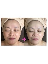 メディカルサロン かとれあ/可愛いすぎる！