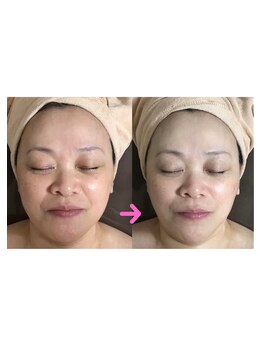 メディカルサロン かとれあ/可愛いすぎる！