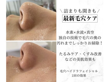 メンズミーシェ(Men's Meshie)の写真