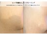 国産ピーリング/陶器肌【つるっと！とヒップに】REVIハーブピーリング¥5500