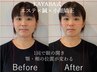 【モニター価格】KAYABA式３Dリフト美容鍼×マッサージ×小顔矯正70分22000円
