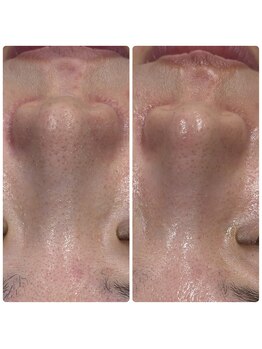 メイス 福井店(MEIS)/お客様Before、After