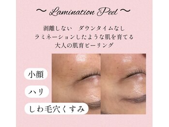 グレイスシャイン(GraceShine)