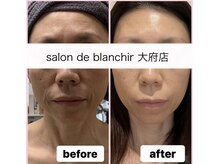 サロンドブランシール(salon de blanchir)の雰囲気（ごっそり毛穴洗浄でザラつきのないツルスベ肌が実現！）