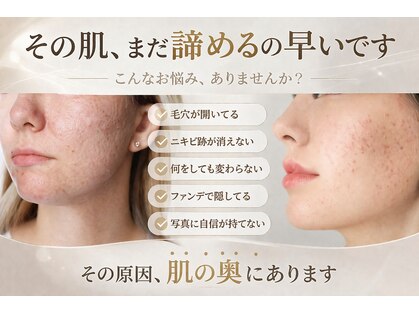 ジャスミン(Jasmin)の写真