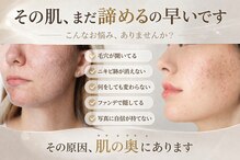 ジャスミン(Jasmin)