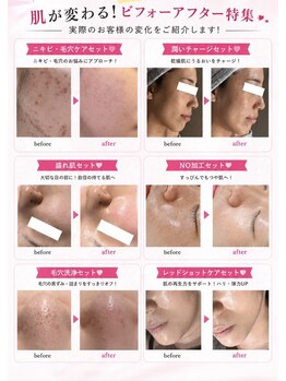 ナーズ(NAZ)の写真/【種類豊富な肌管理】その日のお肌に合ったメニューをご提案します!