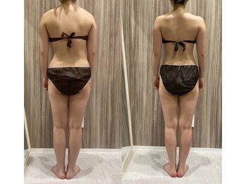 フルリールボーテ(Fleurir Beaut)の写真/筋膜リリースで姿勢改善！体の歪みを整える施術で女性らしい美ボディへ★