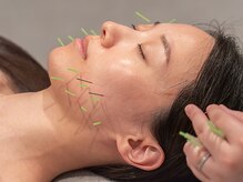 ミトノウミニ 銀座(MITONOUmini)の雰囲気（たるみ・むくみの施術で本来の美しさを取り戻せる美容鍼）