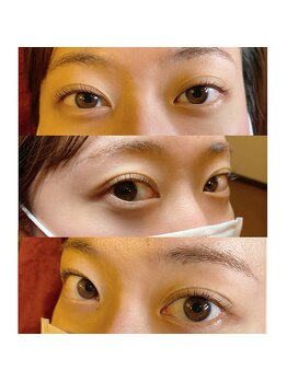 シャンティ(Shanti)/パリジェンヌラッシュリフト