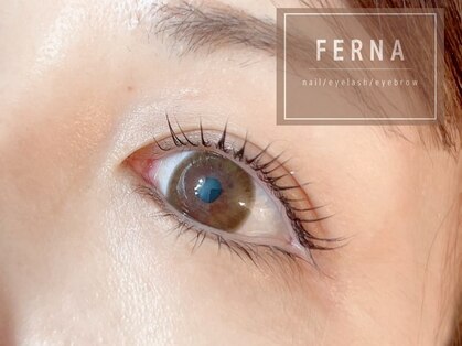 フェルナ(FERNA)の写真