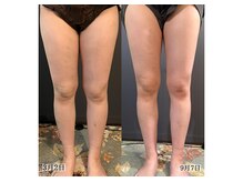 サロンドカメリア(salon de Camellia)/最強マシン導入！