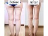美脚へガリ痩せ【特化】つらい浮腫とセルケア燃焼！ふくらはぎまで♪ 60分