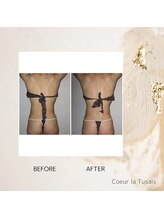 クーラ テュセ(Coeur la Tusais)/上半身集中痩身