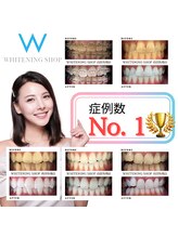 ホワイトニングショップ 高田馬場店/ホワイトニングBeforeAfter