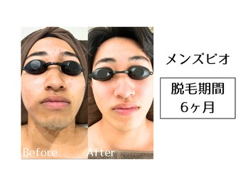 メンズビオ 神戸三宮店/