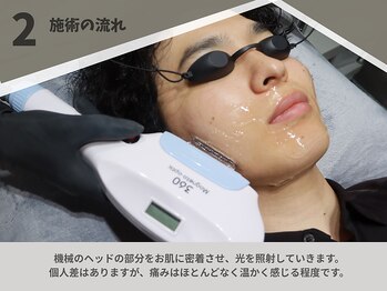 ボス 桑名店(BOSS)/施術の流れ