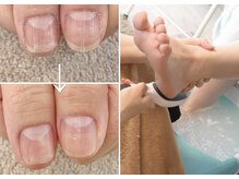 アネラ(ANERA)の雰囲気（自爪のコンプレックス改善！爪質改善育成ケア＆足裏角質極上ケア）