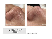 レア(Le'a)/【GLOSS肌ピーリング】