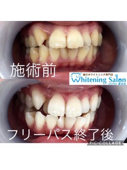 シフォン 豊田店/3週間フリーパス終了のお客様