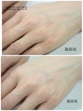 ネイル キャンバス シルヴァ(Nail Canvas Silva.)/大人気美肌光エステ