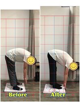 くすの樹接骨院/整体院 鳥栖院/整体/骨盤矯正ビフォーアフター