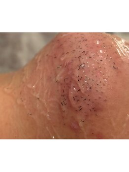 エリクサー 太田店(Elixir)/照射中に抜ける!