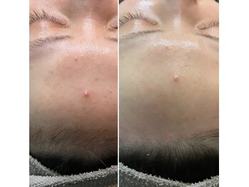 ナチュラヒルズ(Naturahills)/