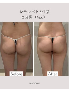 なごみ/脂肪分解【レモンボトル】