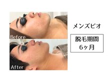 メンズビオ 神戸三宮店/