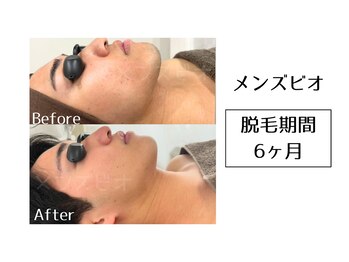 メンズビオ 神戸三宮店/