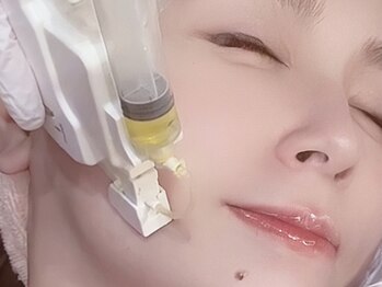 ハイフン(HIFUN)の写真/話題の“レモンボトル”で一撃！たるみ改善・ほうれい線撃退★最前線の脂肪分解ケアで顔面再設計！
