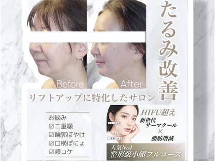 ルミライ(Lumirai)の写真