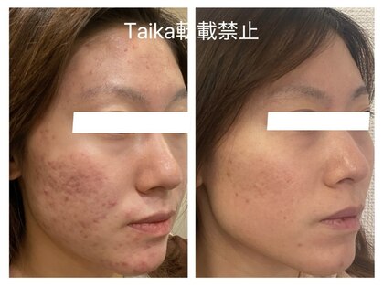 タイカ(Taika)の写真