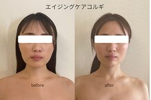 マイ リニュー(My renew)