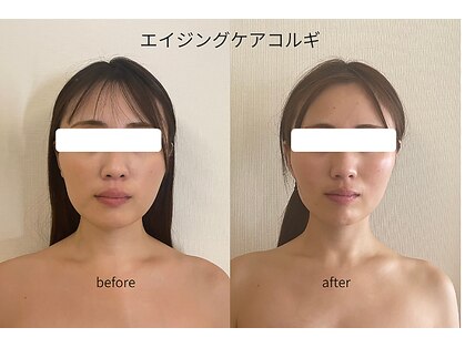 マイ リニュー(My renew)の写真