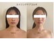マイ リニュー(My renew)の写真