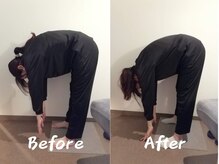 クーオス(KuuOs)/【20代/女性】1回の施術後変化