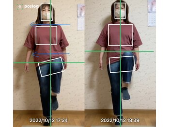 エヴォストレッチ(EVO STRETCH)/60代女性【股関節の違和感】