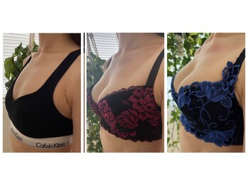 ビービリア(B.villea)/バストアップ施術6回